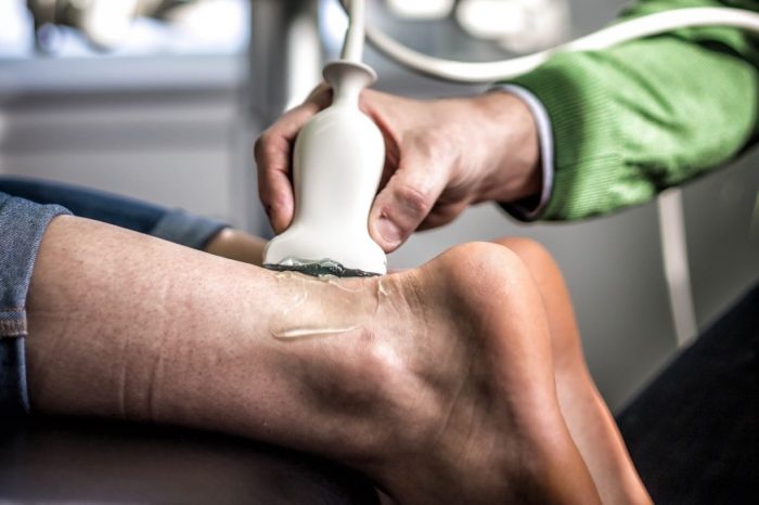 Peroneal Tendinopathy