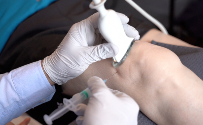 best treatment for a meniscus tear