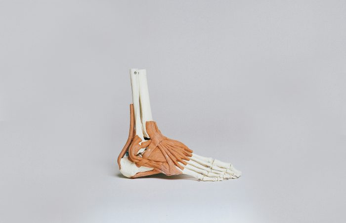 Peroneal Tendinopathy